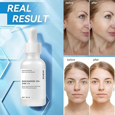 Niacinamide 10% + Zinc 1% Pore Minimising Serum | Oil Control & Clear Skin