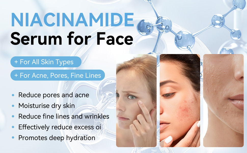 Niacinamide 10% + Zinc 1% Pore Minimising Serum | Oil Control & Clear Skin
