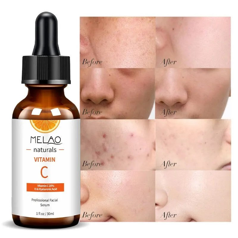 Vitamin C + Hyaluronic Acid Brightening Face Serum | Fade Dark Spots & Glow